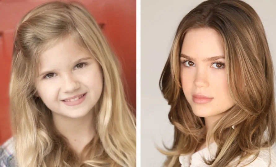 This before and after of Kyla Kenedy shows her facial changes